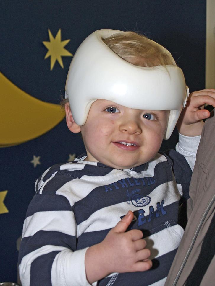Helmtherapie